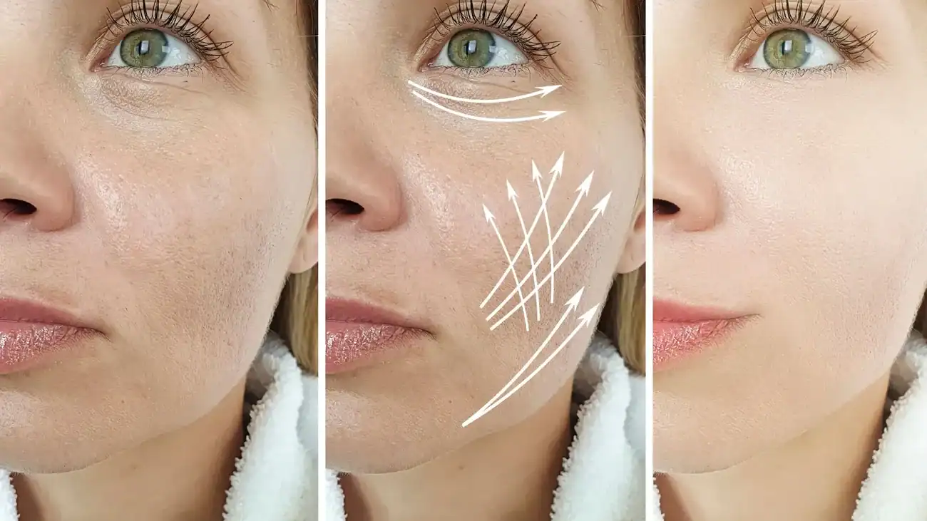 Can One Treatment Really Tackle More Than One Skin Concern Brockenhurst?