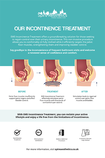 image to show how EMS treatment works for female urinary incontinence Brockenhurst