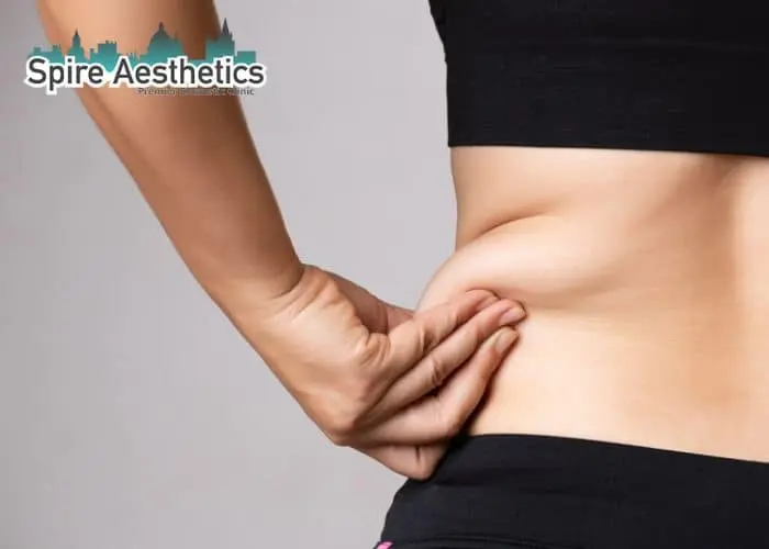 Image of woman pinching fat on their hips Brockenhurst. Fat Freezing treatment