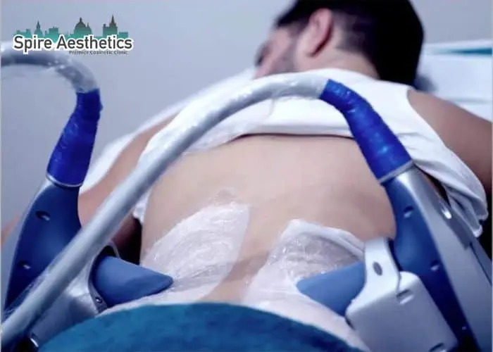 Man having fat freezing treatment done on love handles before a competitions Brockenhurst to create a sculpted look.