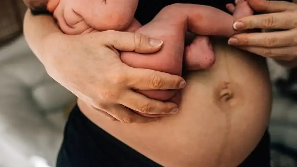 Why Is My Stomach Still Big After Pregnancy Brockenhurst?